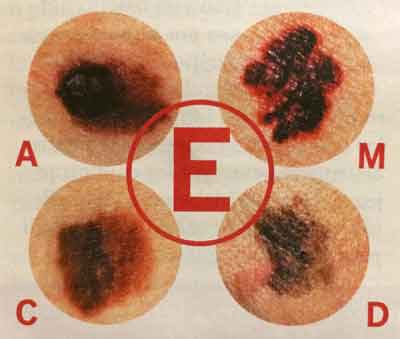 Alunitele pot fi riscante